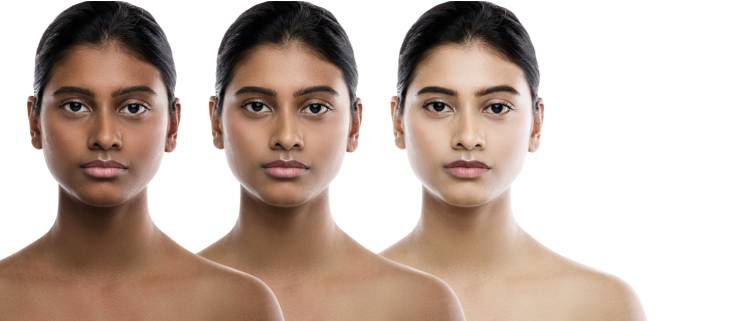 Skin Whitening Treatment in Bangalore